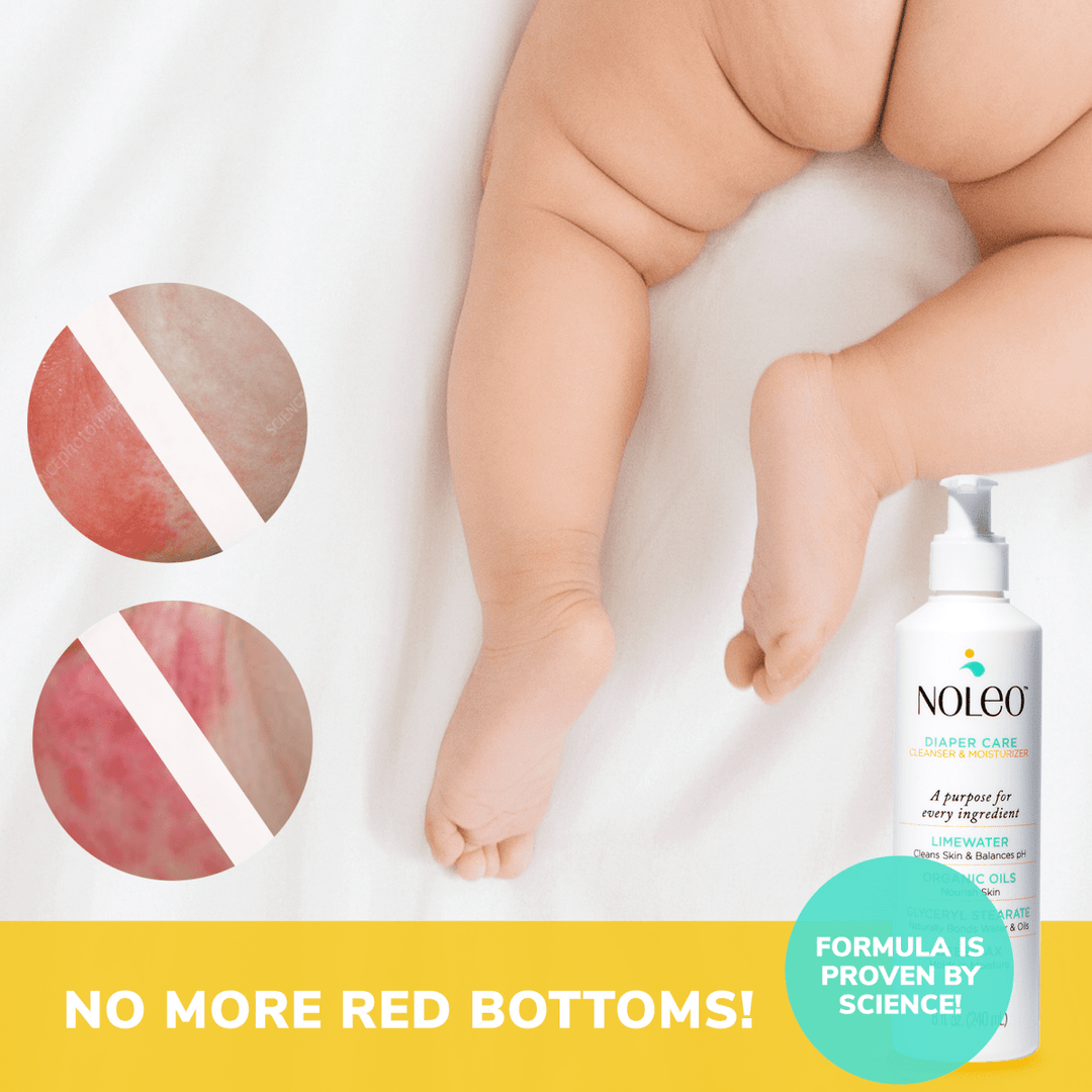 NOLEO 3-IN-1 - Diaper Rash Cream - EWG Verified
