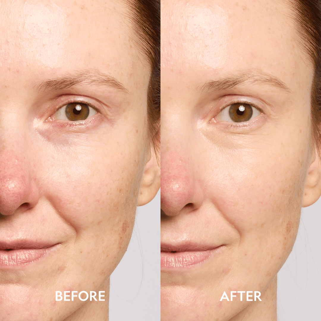 Super Bright Dark Circle Serum Peptide Corrector